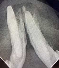 value ofdental radiography _img